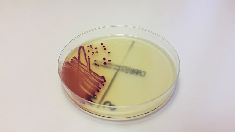 Tarmbakterien Escherichia coli (förkortat E. coli) på en rund plastplatta.